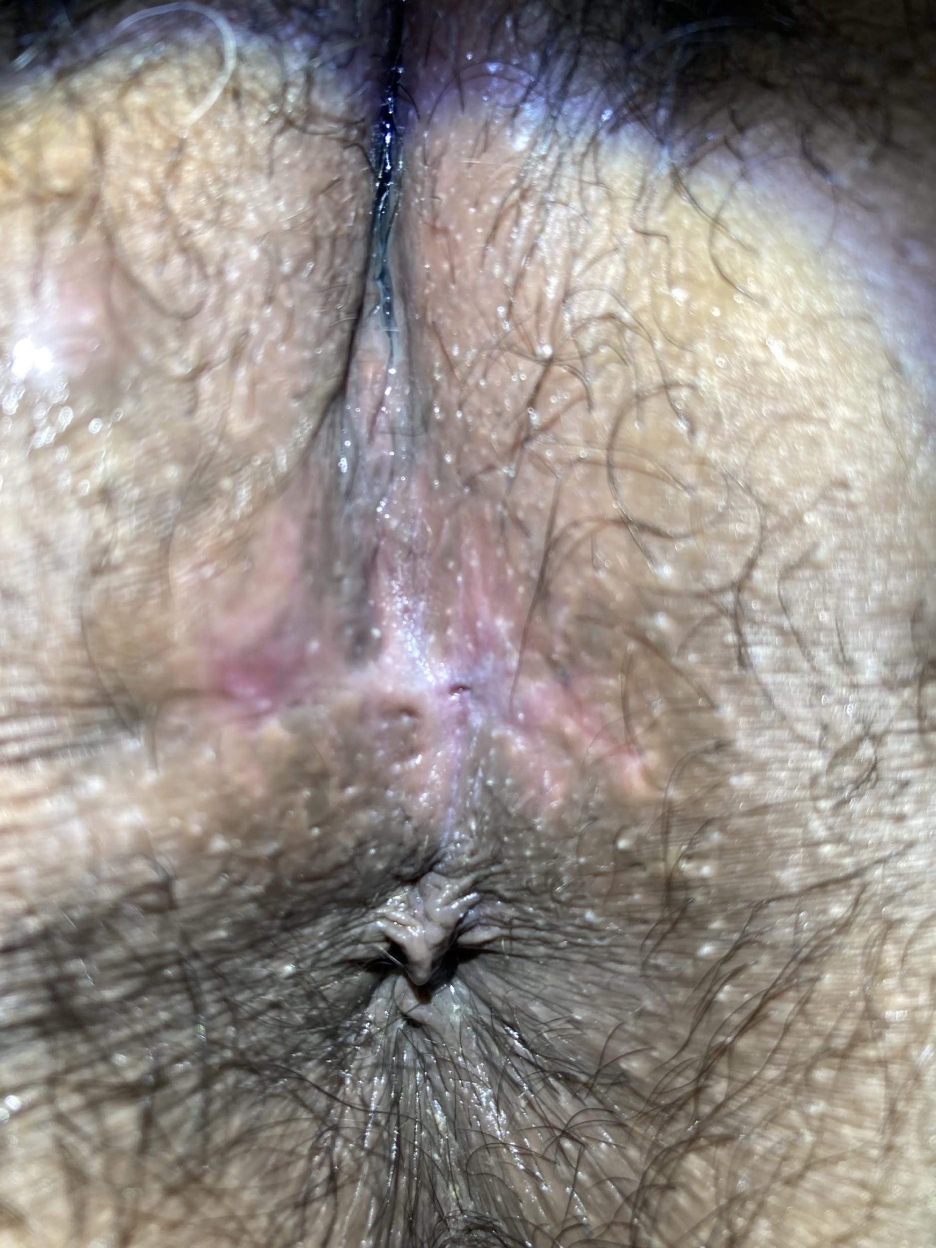 Surgery